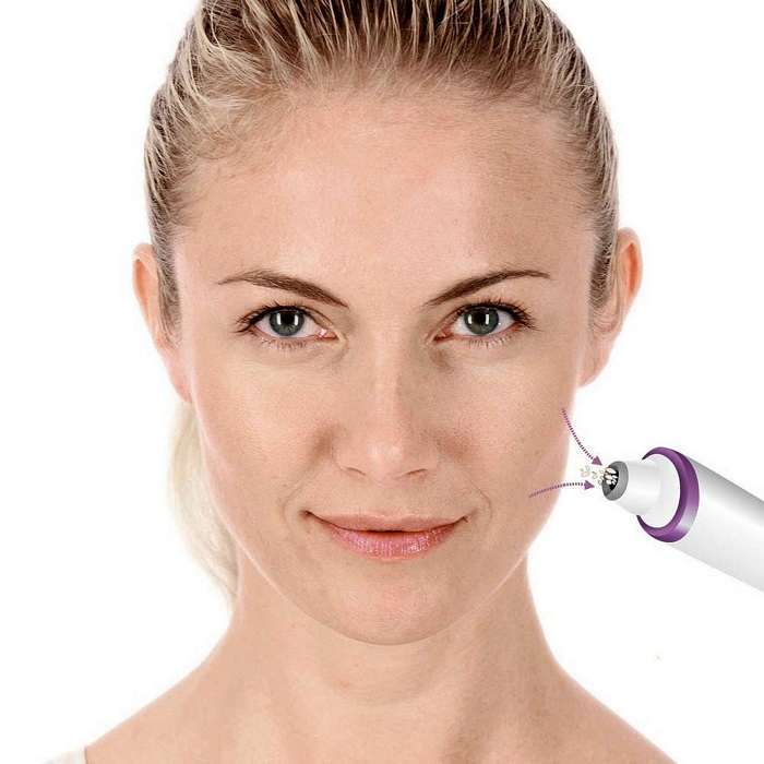 Апарат для мікродермабразії FC 76 BEURER