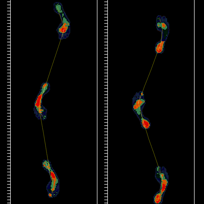 Индивидуальные ортопедические стельки Stopa повторно + диагностика