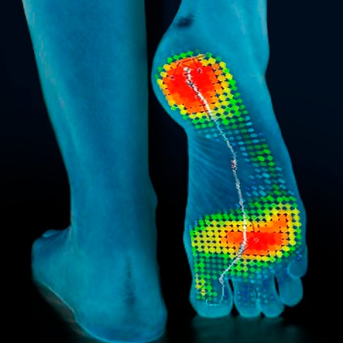 Индивидуальные ортопедические стельки Stopa повторно + диагностика