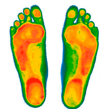 Компьютерная диагностика стоп на сканере и динамической платформе