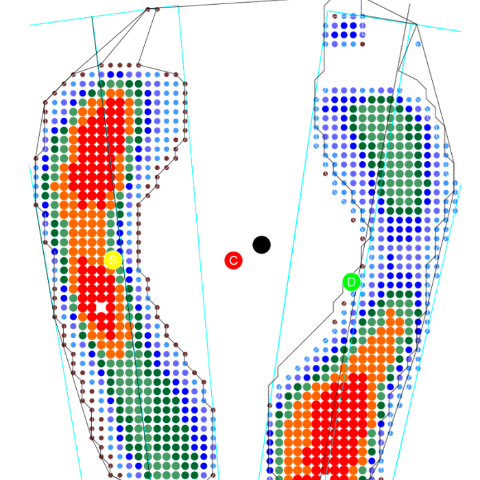 Компьютерная диагностика стоп на сканере и динамической платформе