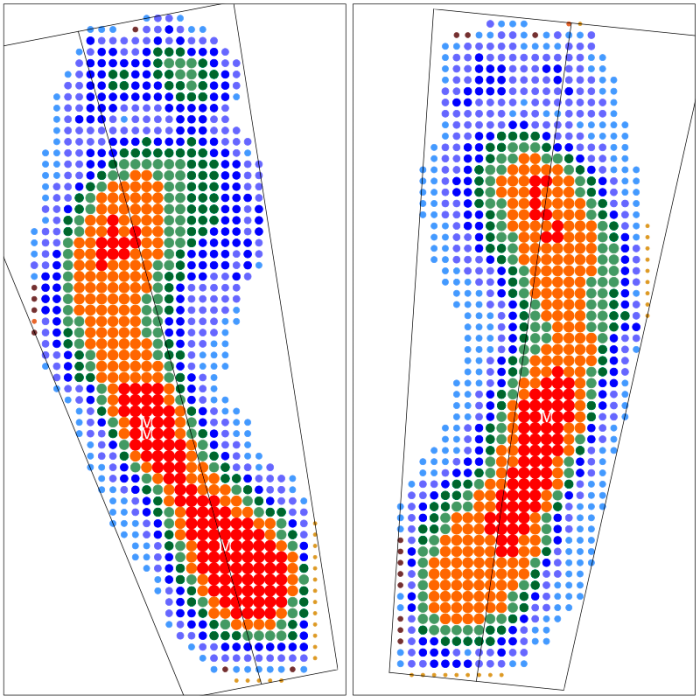 Компьютерная диагностика стоп на сканере и динамической платформе
