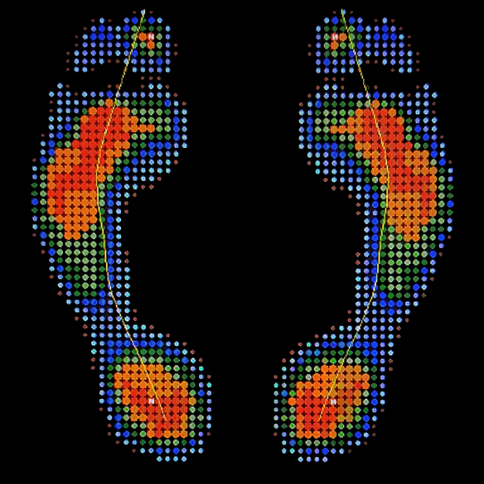 Индивидуальные ортопедические стельки Stopa повторно + диагностика