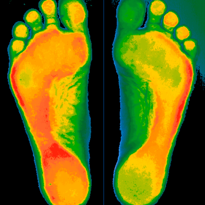 Индивидуальные ортопедические стельки Stopa повторно + диагностика