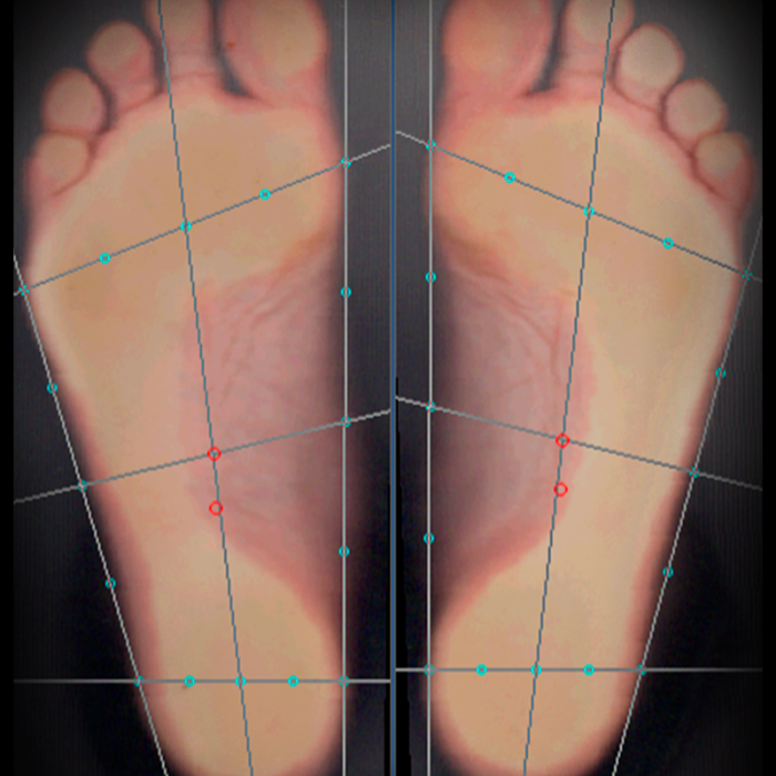 Индивидуальные ортопедические стельки Stopa повторно + диагностика