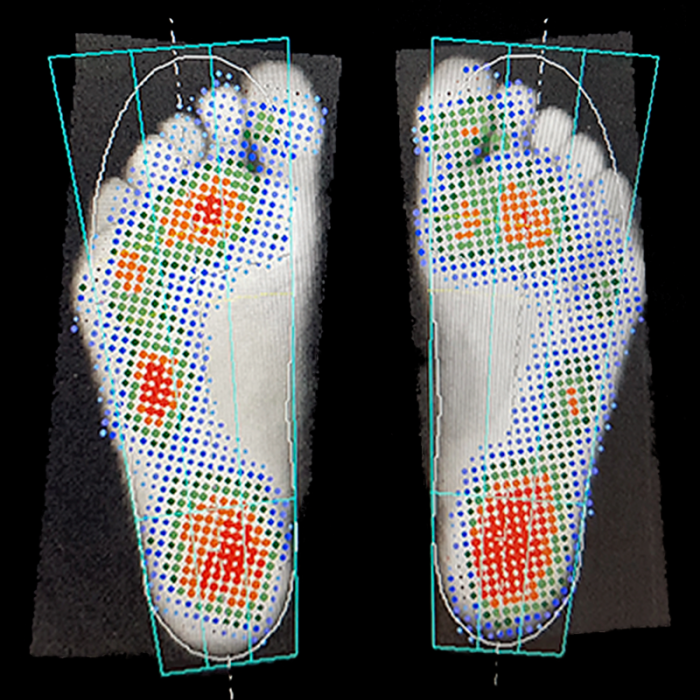 Индивидуальные ортопедические стельки Stopa детям + диагностика