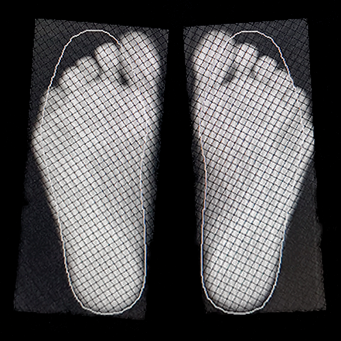 Индивидуальные ортопедические стельки Stopa детям + диагностика