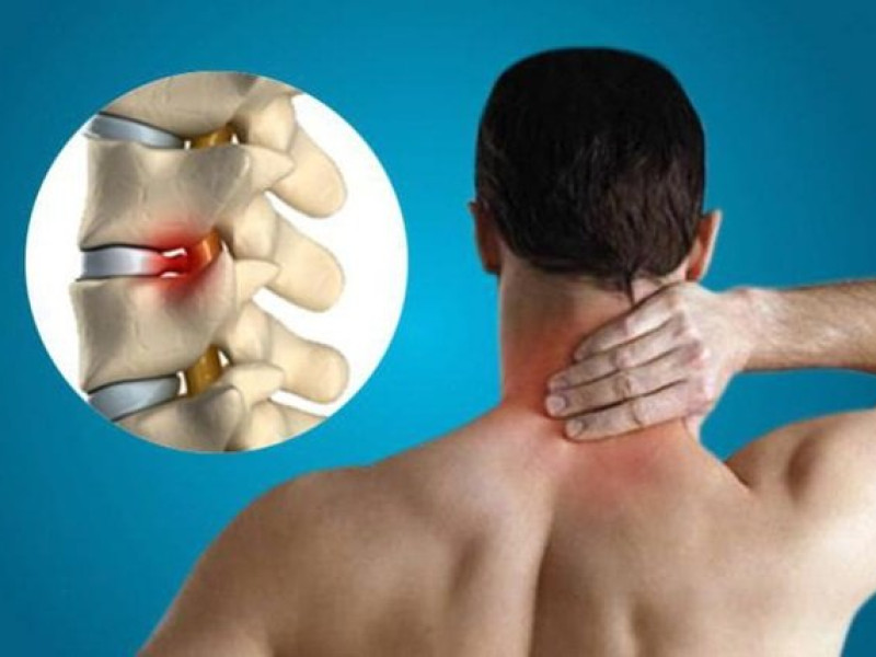 Заболевания шейного отдела и их последствия