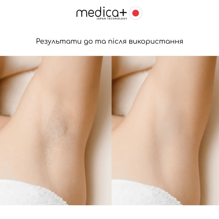 Фотоепілятор MEDICA+ Haircleaner 8.0