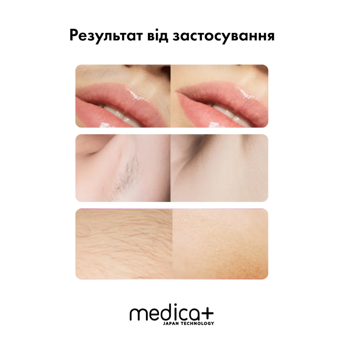 Фотоепілятор Medica+ Haircleaner 5.0 IPL