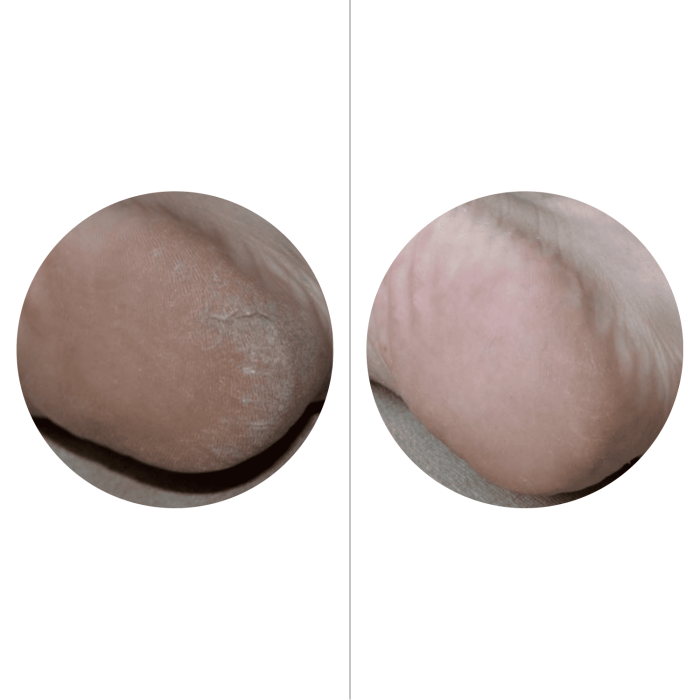 MonnaLi Інтенсивний крем для п'ят від тріщин та сухості