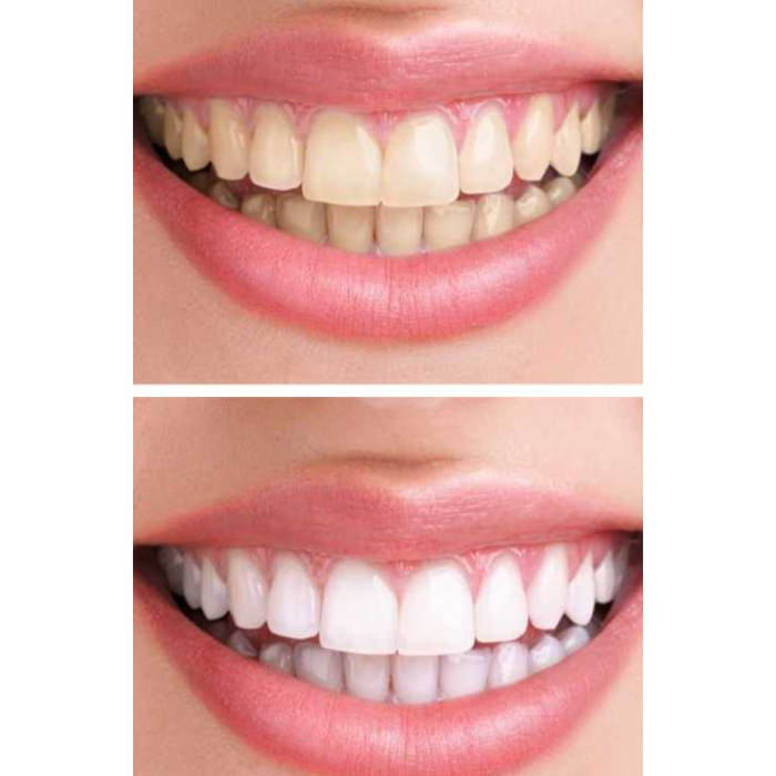 Набір звукових зубних щіток MEDICA+ PROBRUSH 7.0 black + fuchsia