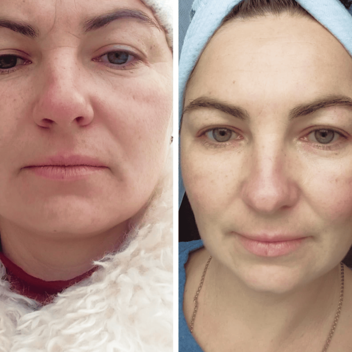 Заспокійлива маска для обличчя MEDICA+ Soothing Mask (50 мл)