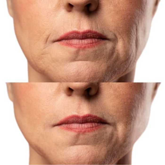 Набір Мікрострумовий RF Lifting Масажер для обличчя Skin Lifting 7.0 White + Струмопровідний гель + Заспокійлива маска для обличчя MEDICA+