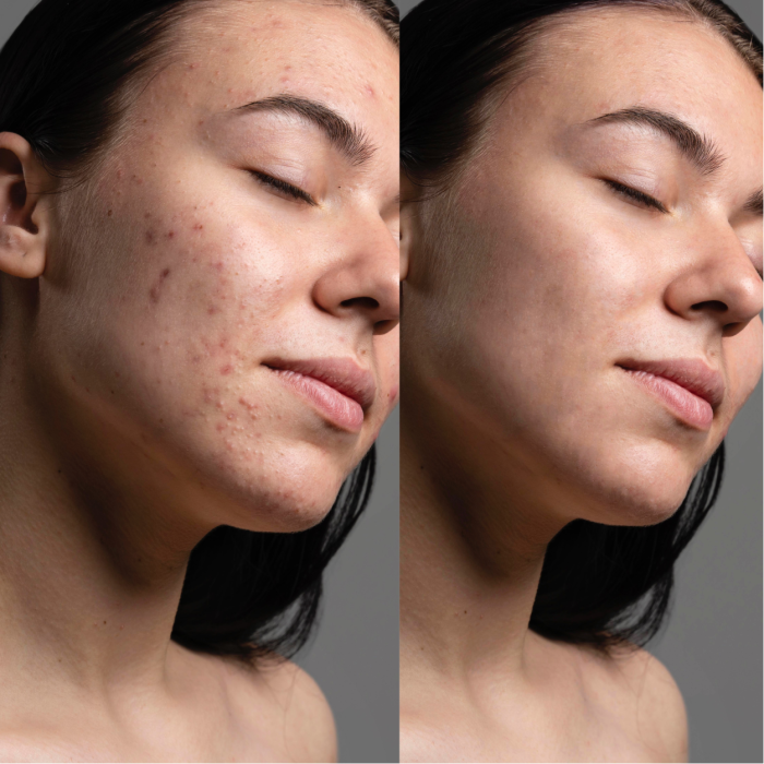 LED-маска для мікрострумової та світлотерапії Medica+ LEDMask 7X