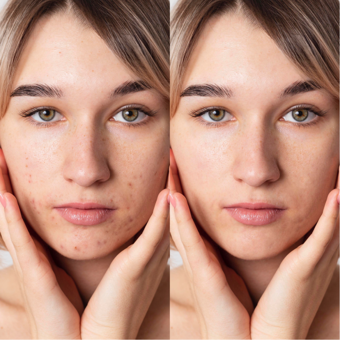 LED-маска для мікрострумової та світлотерапії Medica+ LEDMask 7X