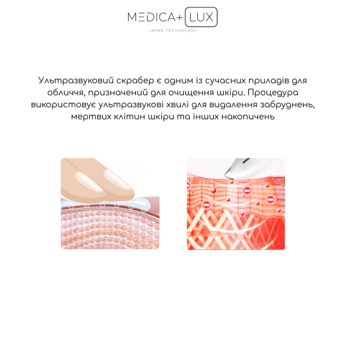 Ультразвуковий скрабер MEDICA+ Lux SuperSonic 10 + Інструменти EasyClean PRO